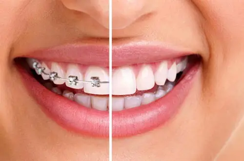 Orthodontiste Tanger