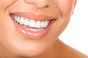 dents blanche10s.jpg