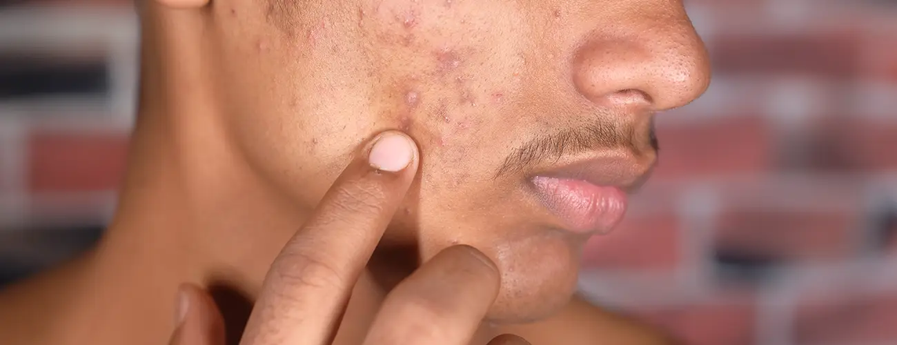 Dermatologie esthétique Maroc