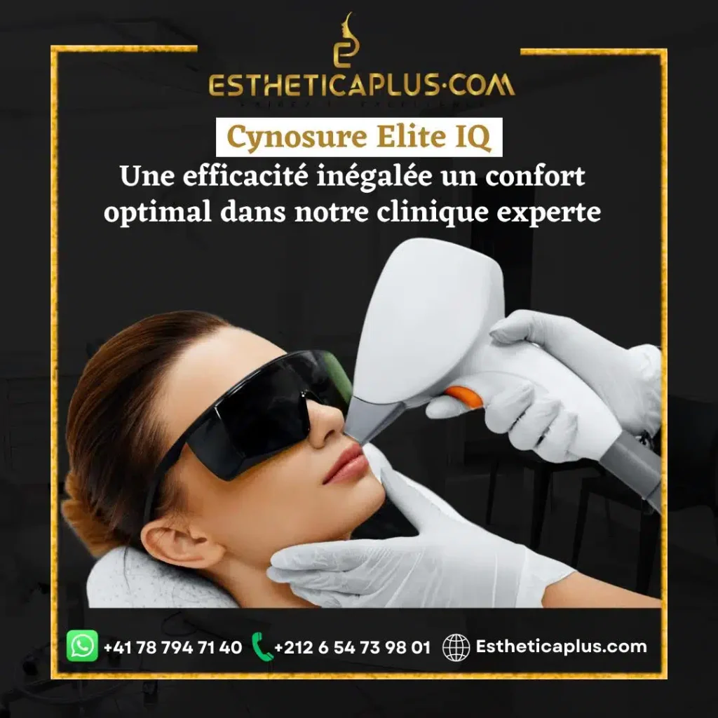 EPILATION DEFINITIVE TANGER.jpg 1