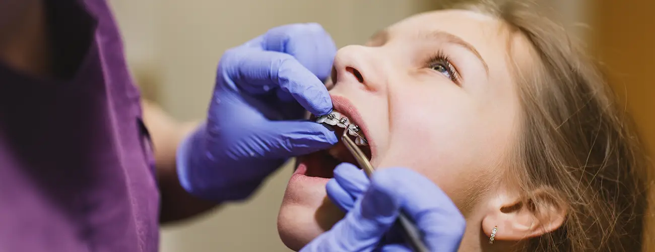 Orthodontiste à Tanger pour les enfants et les adultes