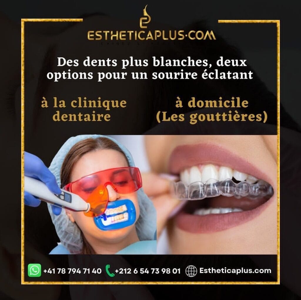 BLANCHIMENT DENTAIRE MAROC 1