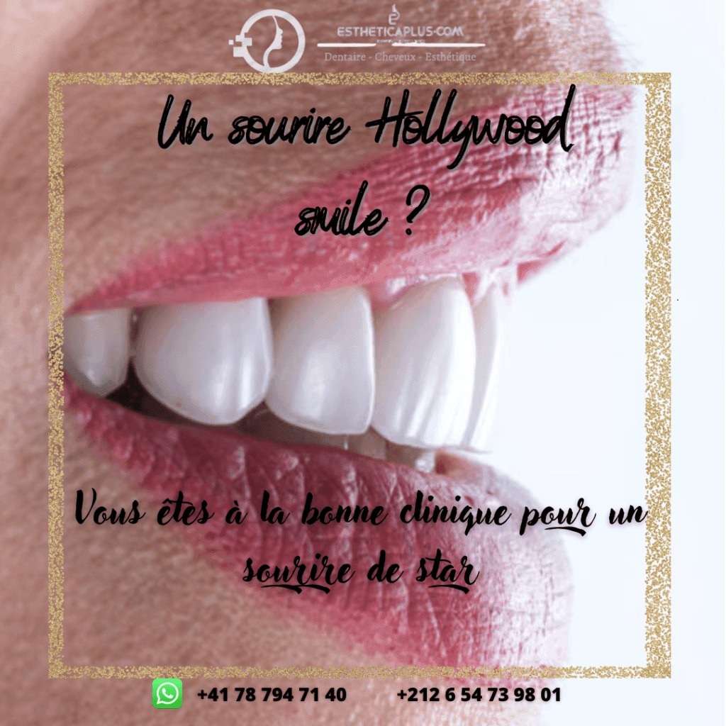 sourire holywood smile tanger