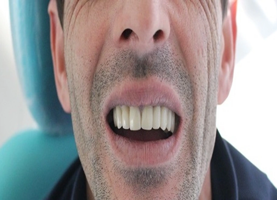 Après — cas 02 EstheticaPlus