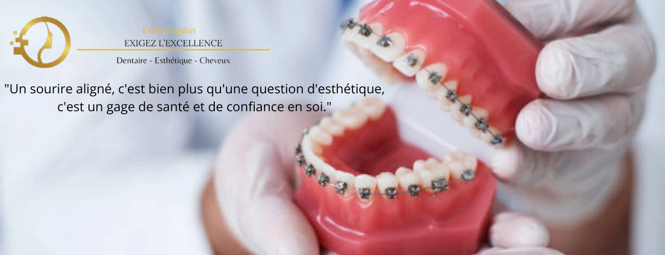 Chez EstheticaPlus, l'orthodontie au meilleur prix à Tanger