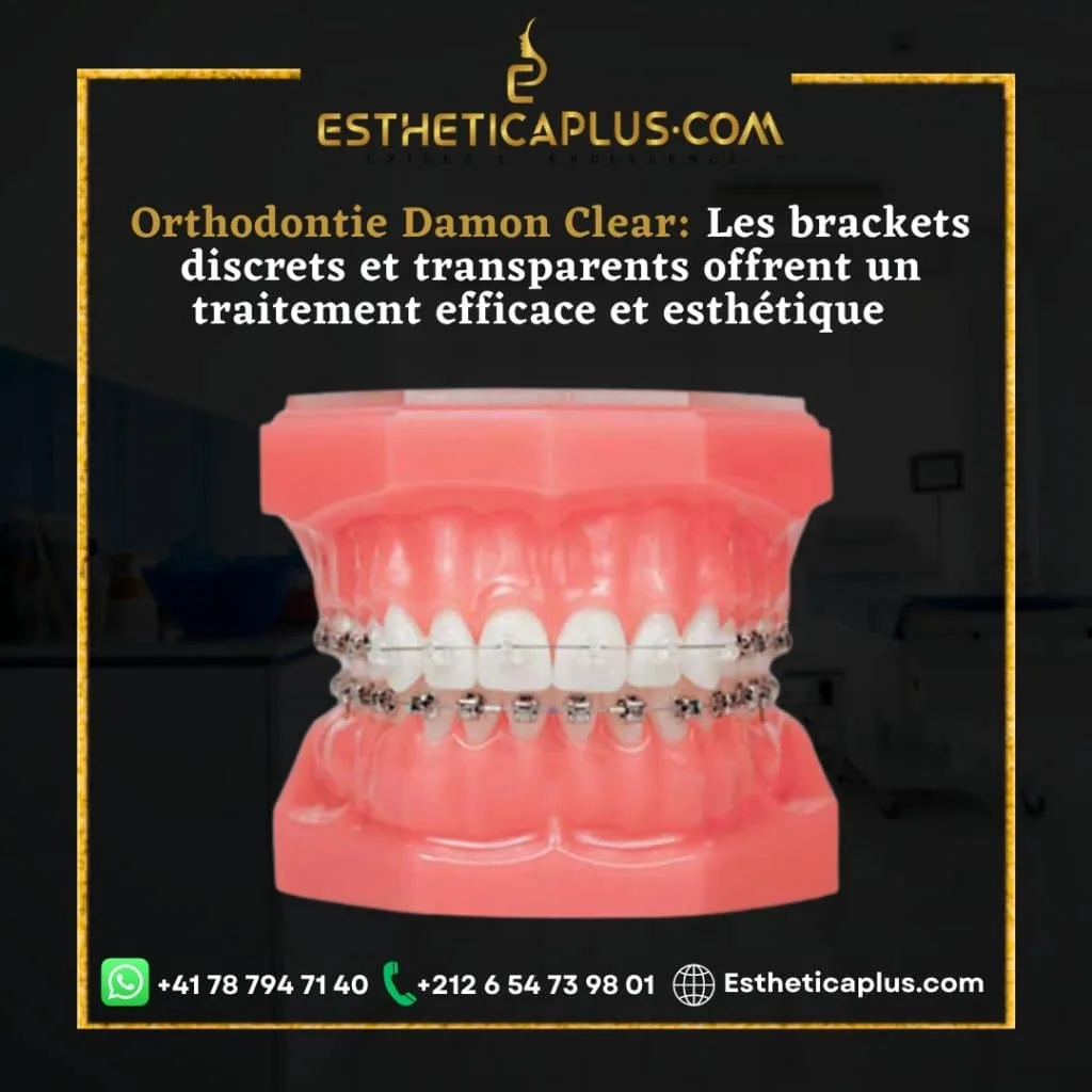 orthodontie tanger prix