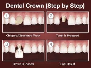 crown step by step e1738323579611