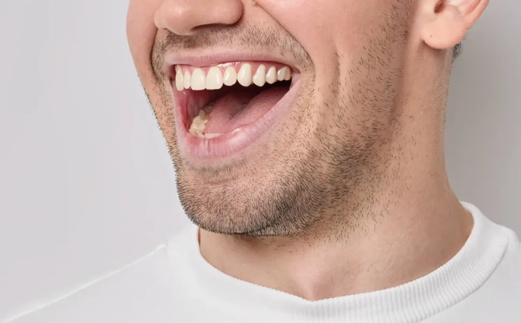 sourire dentaire au Maroc avec des dents saines