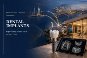 High-Quality Dental Implants in Morocco | Affordable Alternative for USA & Europe