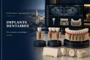 Les implants dentaire au Maroc : Prix, solutions et avantages