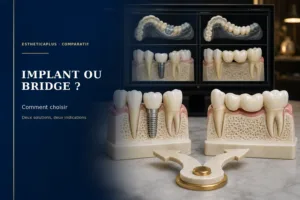 Comment choisir entre un implant dentaire et un bridge ? | EstheticaPlus
