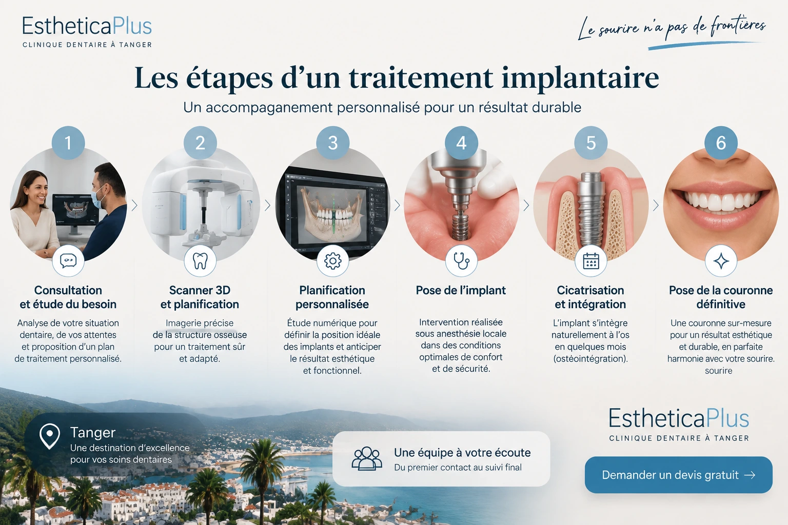 Les étapes d'un traitement implant dentaire au Maroc