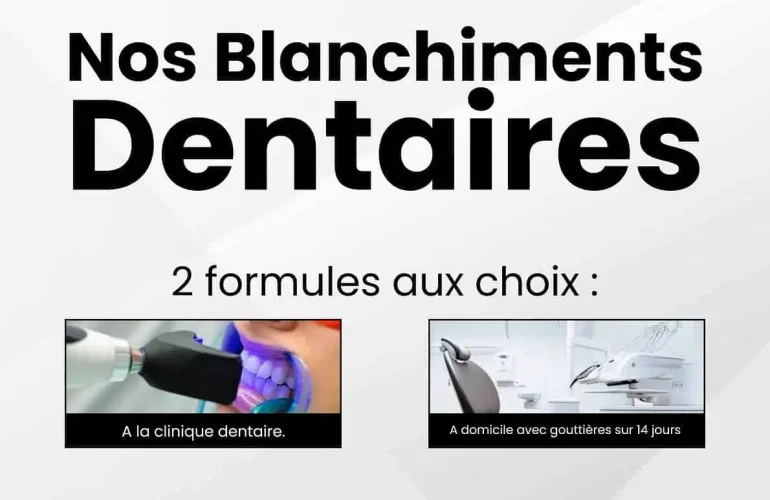 BLANCHIMENT-DENTAIRE-TANGER-AU-MEILLEUR-PRIX.jpeg